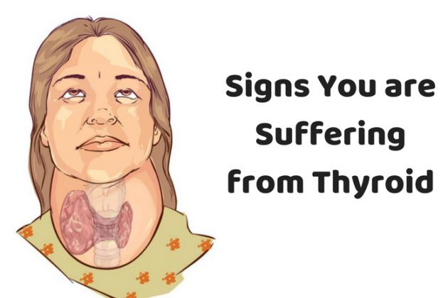 Signs You are Suffering from Thyroid