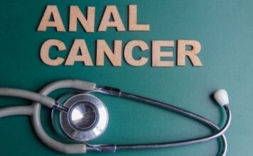 Anal Cancer - Symptoms, Causes, Prevention, and Treatment