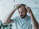 causes of hair loss and baldness in men